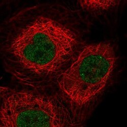OGFOD3 Antibody, Novus Biologicals 0.1mL; Unlabeled:Antibodies, Polyclonal