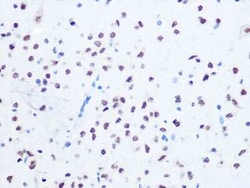 OGG1 Rabbit anti-Human, Mouse, Rat, Clone: 8V2Q9, Novus Biologicals:Antibodies:Primary