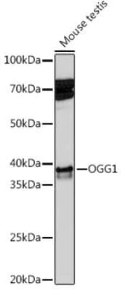 OGG1 Rabbit anti-Human, Mouse, Rat, Clone: 8V2Q9, Novus Biologicals:Antibodies:Primary