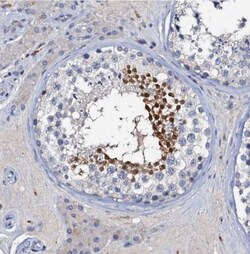 OLAH Antibody, Novus Biologicals 0.1mL; Unlabeled:Antibodies, Polyclonal