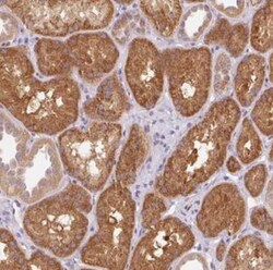 OMA1 Antibody, Novus Biologicals 25 &mu;L, Unlabeled:Antibodies, Polyclonal