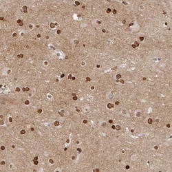 OMgp Antibody, Novus Biologicals 0.1mL; Unlabeled:Antibodies, Polyclonal