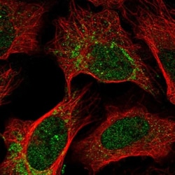 OPA1 Antibody, Novus Biologicals 25 &mu;L, Unlabeled:Antibodies, Polyclonal