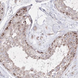 OPA1 Antibody, Novus Biologicals 25 &mu;L, Unlabeled:Antibodies, Polyclonal