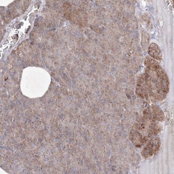 OPA1 Antibody, Novus Biologicals 25 &mu;L, Unlabeled:Antibodies, Polyclonal