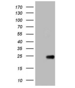 OPA3 Antibody (OTI3G4), Novus Biologicals 0.1mL; Unlabeled:Antibodies,