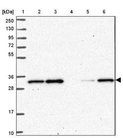 OR10C1 Antibody, Novus Biologicals 0.1mL; Unlabeled:Antibodies, Polyclonal