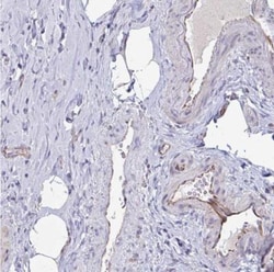 OR1L3 Antibody, Novus Biologicals:Antibodies:Primary Antibodies