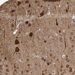 OR2K2 Antibody, Novus Biologicals 0.1mL; Unlabeled:Antibodies, Polyclonal