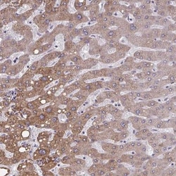 OR4A47 Antibody, Novus Biologicals 25 &mu;L | Buy Online | Novus Biologicals | Fisher Scientific