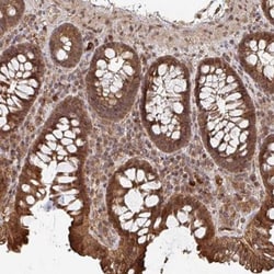 OR4C15 Antibody, Novus Biologicals:Antibodies:Primary Antibodies