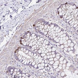 OR4P4 Antibody, Novus Biologicals 25 &mu;L, Unlabeled:Antibodies, Polyclonal