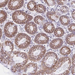 OR51M1 Antibody, Novus Biologicals:Antibodies:Primary Antibodies