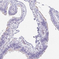 OR5J2 Antibody, Novus Biologicals 25 &mu;L, Unlabeled:Antibodies, Polyclonal