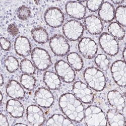 OR6T1 Antibody, Novus Biologicals:Antibodies:Primary Antibodies