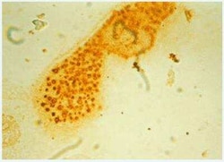 Novus Biologicals&trade;&nbsp;ORANGE Peroxidase Substrate Kit