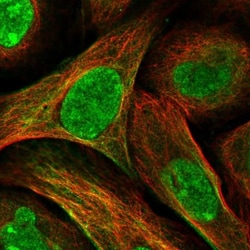 ORC1 Antibody, Novus Biologicals 0.1mL; Unlabeled:Antibodies, Polyclonal