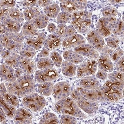 ORF1 FL49 Antibody, Novus Biologicals 0.1mL; Unlabeled:Antikroppar