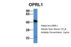 ORL1/OPRL1 Antibody, Novus Biologicals:Antibodies:Primary Antibodies