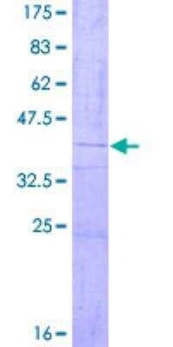 Novus Biologicals Recombinant Human ORMDL2 GST (N-Term) Protein 2 &mu;g | Buy Online | Novus Biologicals&trade; | Fisher Scientific
