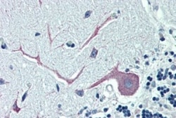 ORP1 Antibody, Novus Biologicals 0.1mg; Unlabeled:Antibodies, Polyclonal