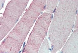 ORP1 Antibody, Novus Biologicals 0.1mg; Unlabeled:Antibodies, Polyclonal