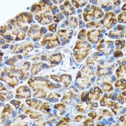 ORP150/HSP12A Rabbit anti-Human, Mouse, Rat, Clone: 6H7X2, Novus Biologicals:Antibodies:Primary