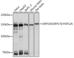 ORP150/HSP12A Rabbit anti-Human, Mouse, Rat, Clone: 6H7X2, Novus Biologicals:Antibodies:Primary
