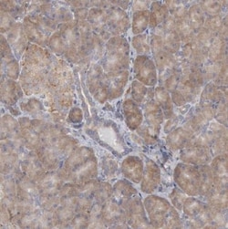 ORP8 Antibody, Novus Biologicals 25 &mu;L, Unconjugated:Antibodies, Polyclonal