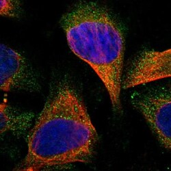 OSBP2 Antibody, Novus Biologicals 0.1mL; Unlabeled:Antibodies, Polyclonal