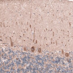 OSBP2 Antibody, Novus Biologicals 0.1mL; Unlabeled:Antibodies, Polyclonal