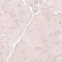 OSBP2 Antibody, Novus Biologicals 0.1mL; Unlabeled:Antibodies, Polyclonal