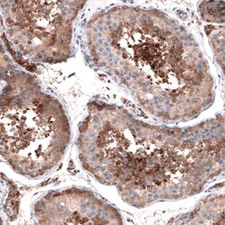 OSBP2 Antibody, Novus Biologicals 0.1mL; Unlabeled:Antibodies, Polyclonal
