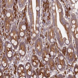 OSBPL2 Antibody, Novus Biologicals 0.1mL; Unlabeled:Antibodies, Polyclonal