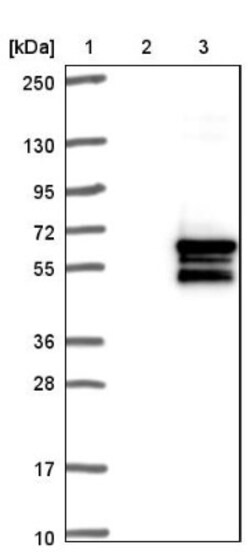 OSBPL2 Antibody, Novus Biologicals 0.1mL; Unlabeled:Antibodies, Polyclonal