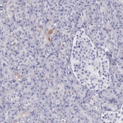 OSBPL3 Antibody, Novus Biologicals 0.1mL; Unlabeled:Antibodies, Polyclonal