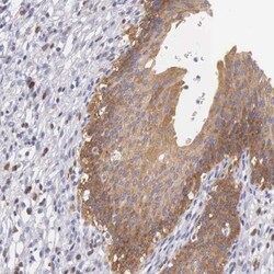 OSBPL3 Antibody, Novus Biologicals 0.1mL; Unlabeled:Antibodies, Polyclonal