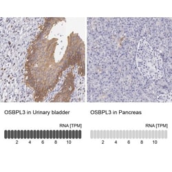 OSBPL3 Antibody, Novus Biologicals 0.1mL; Unlabeled:Antibodies, Polyclonal