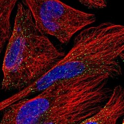 OSBPL5 Antibody, Novus Biologicals 0.1mL; Unlabeled:Antibodies, Polyclonal