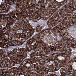 OSBPL5 Antibody, Novus Biologicals 0.1mL; Unlabeled:Antibodies, Polyclonal