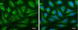 OSBPL6 Antibody, Novus Biologicals 0.1mg; Unlabeled:Antibodies, Polyclonal