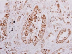 OSBPL6 Antibody, Novus Biologicals 0.1mg; Unlabeled:Antibodies, Polyclonal