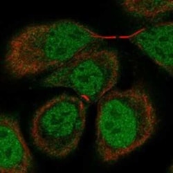 OSBPL7 Rabbit anti-Human, Polyclonal, Novus Biologicals 100 &mu;g; Unconjugated:Antibodies,