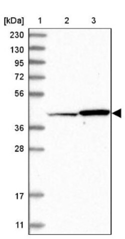 OSGEPL1 Antibody, Novus Biologicals 25 &mu;L | Buy Online | Novus Biologicals | Fisher Scientific