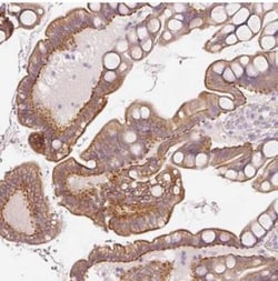 OSR2 Antibody, Novus Biologicals:Antibodies:Primary Antibodies