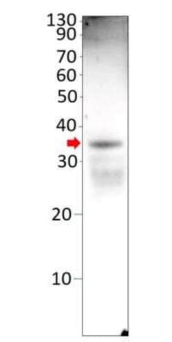 OSR2 Antibody, Novus Biologicals 100 &mu;g | Buy Online | Novus Biologicals | Fisher Scientific