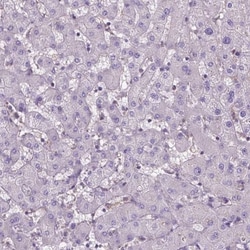 OSTB Antibody, Novus Biologicals 0.1 mL | Buy Online | Novus Biologicals | Fisher Scientific