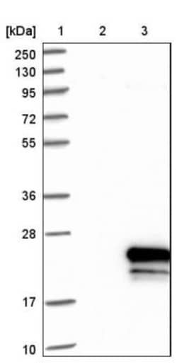 OSTB Antibody, Novus Biologicals 0.1 mL | Buy Online | Novus Biologicals | Fisher Scientific