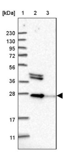 OSTF1 Antibody, Novus Biologicals:Antibodies:Primary Antibodies