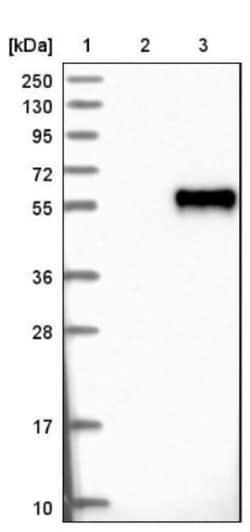 OSTM1 Antibody, Novus Biologicals:Antibodies:Primary Antibodies